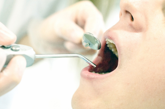 虫歯は早期発見・早期治療が基本です